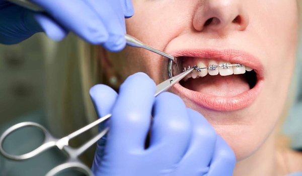 Quel est le rôle d'un orthodontiste ?